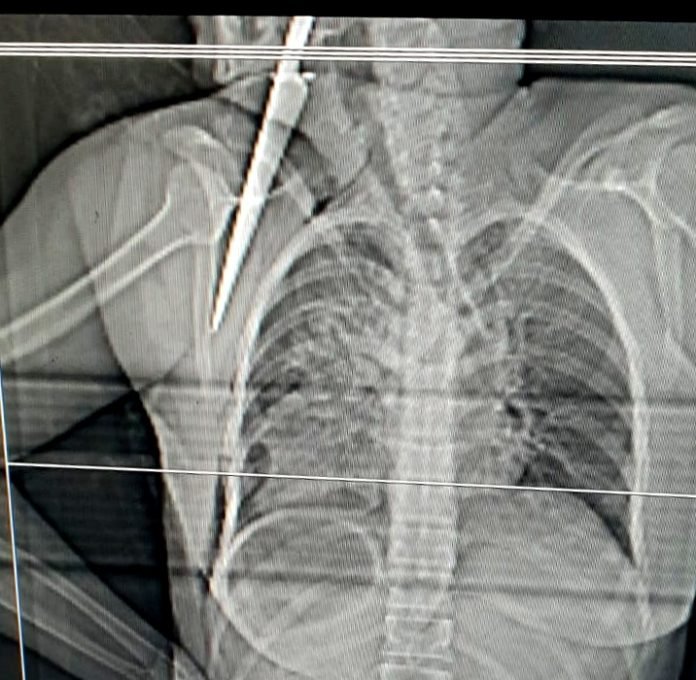 PCES e PMES prendem suspeito de tentativa de feminicídio em Pinheiros 