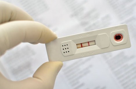 Teste rápido de dengue já disponível nas unidades de saúde - Itapemirim-ES