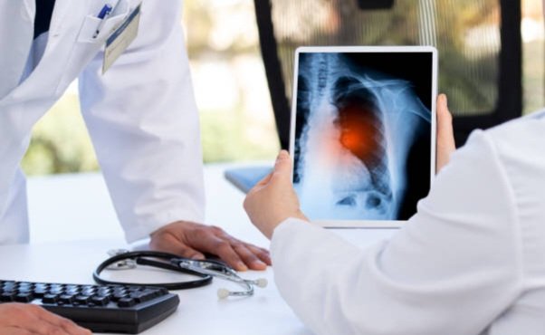 Cachoeiro realiza treinamentos para qualificar atendimento a pacientes com tuberculose - Prefeitura de Cachoeiro de Itapemirim