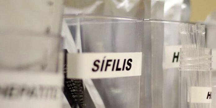 Centro de SP tem testagem grátis de HIV, hepatite, síflis e gonorreia